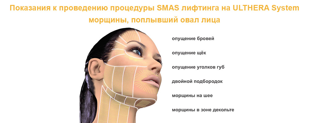 Смас лифтинг в Esthetic Clinic фото 030303