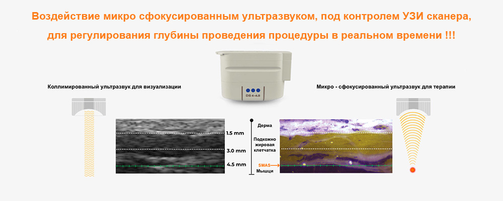 SMAS лифтинг - безоперационная подтяжка кожи микро сфокусированным ультразвуком  на оригинальном аппарате ULTHERA System 050505 